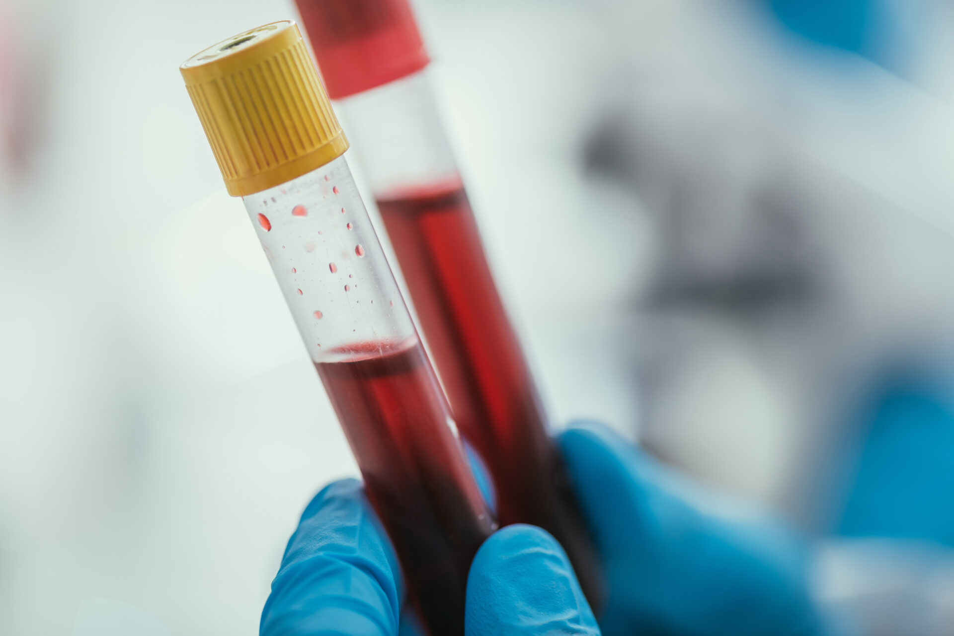 partial view of biochemist holding test tubes with blood samples